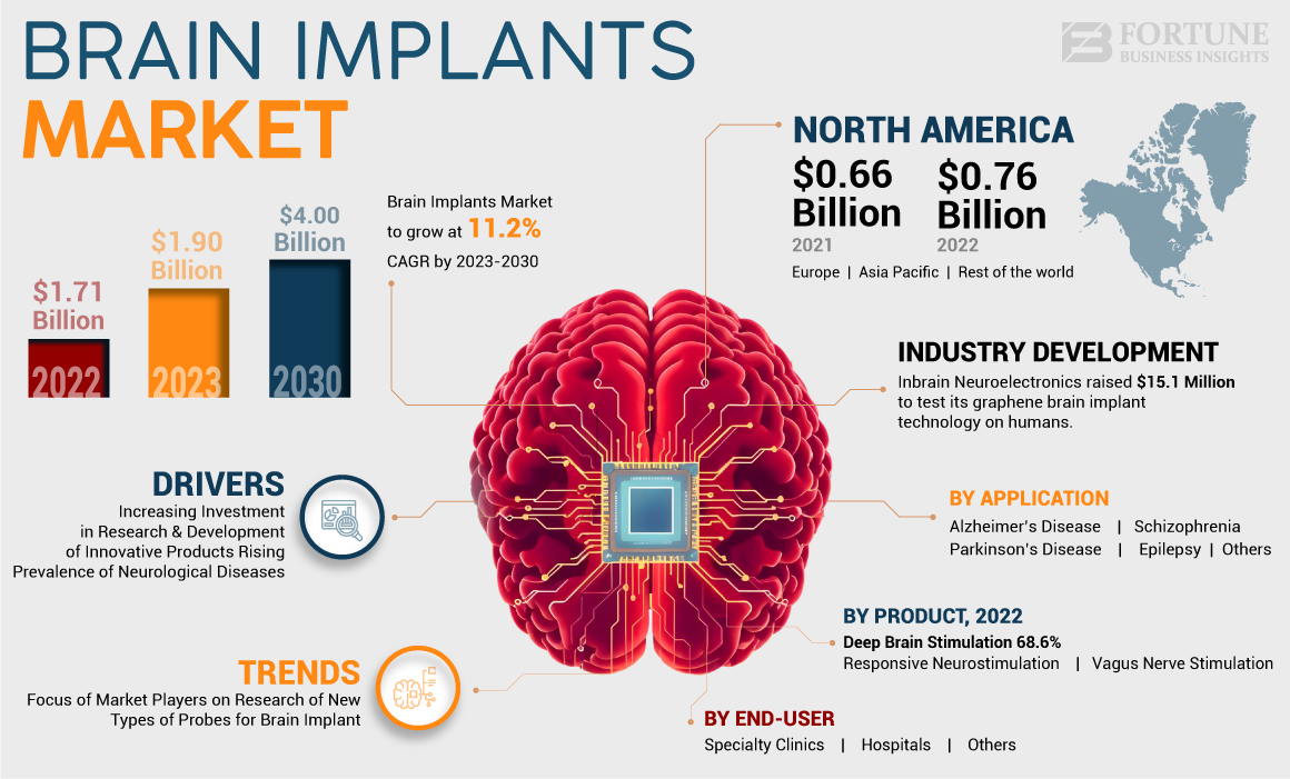 Brain Implants Market