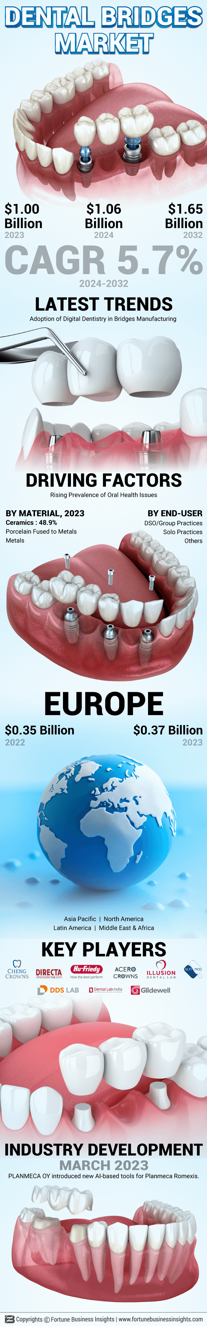 Dental Bridges Market