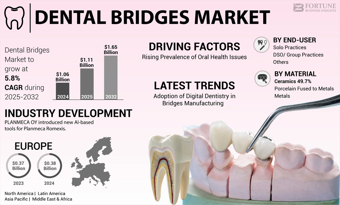 Dental Bridges Market