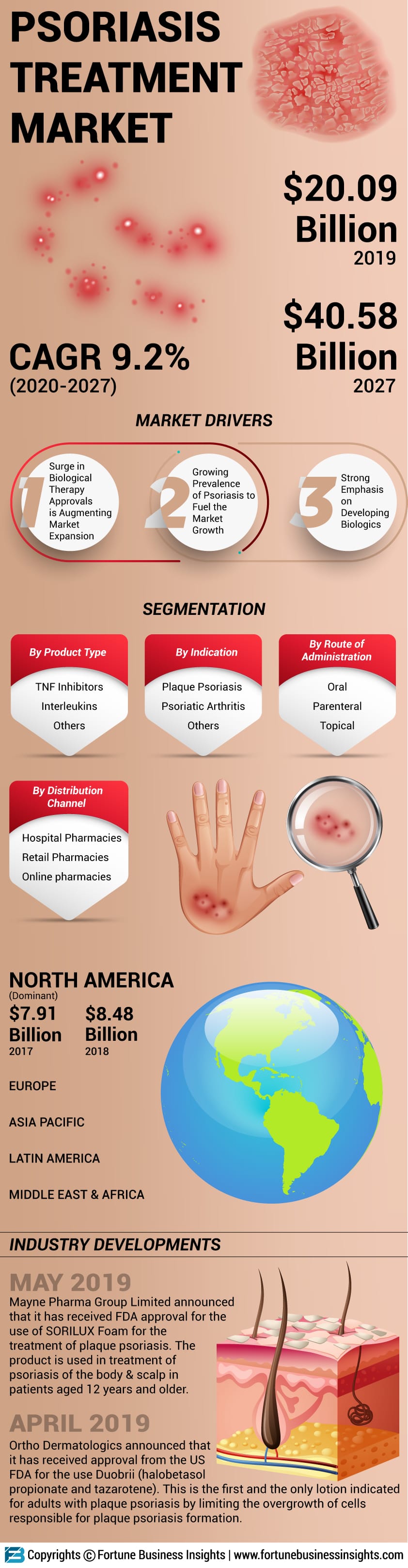 Infographics - Psoriasis Treatment Market