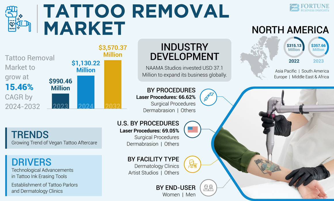 Tattoo Removal Market