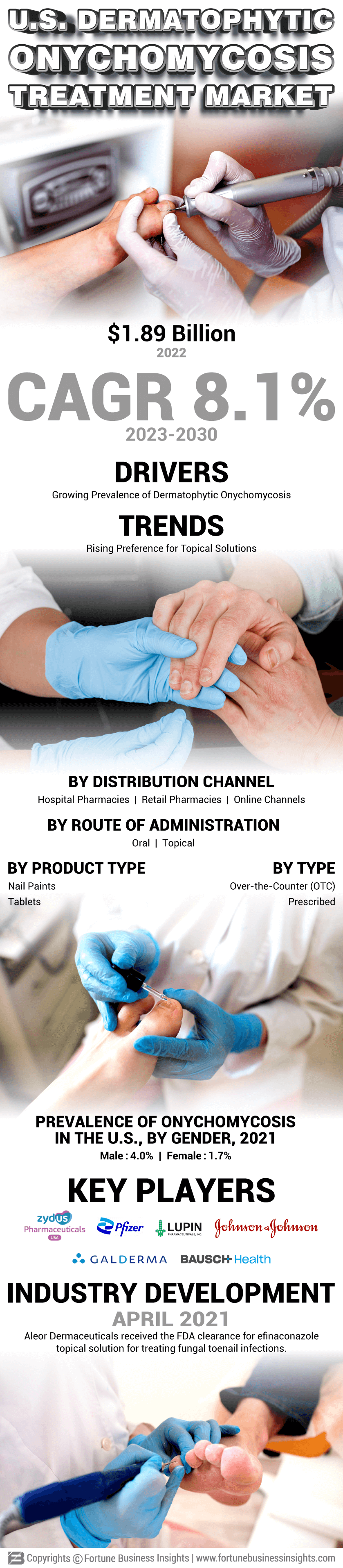 U.S. Dermatophytic Onychomycosis Treatment Market