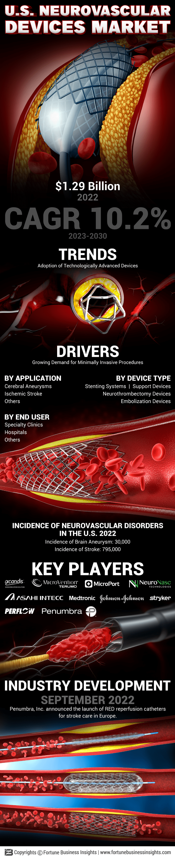 U.S. Neurovascular Devices Market