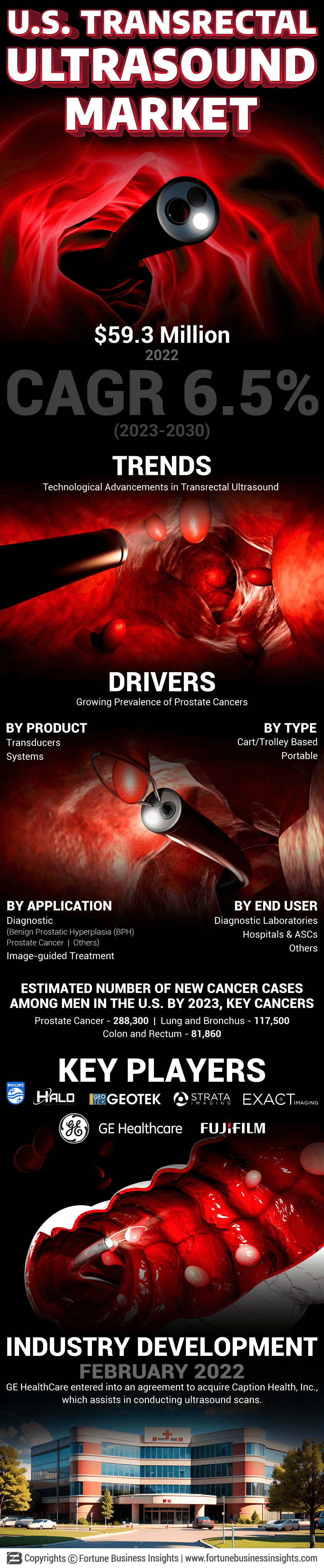 U.S. Transrectal Ultrasound Market